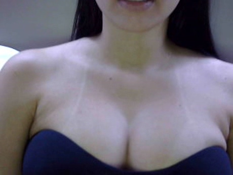 analu20