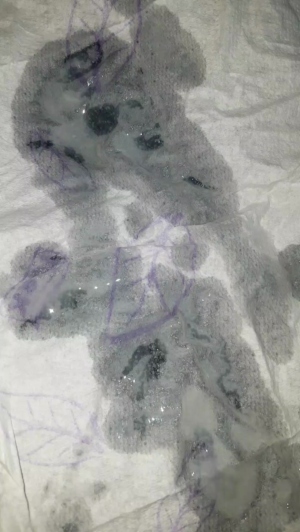 stipe 02-06-2019  Recorded Video Free