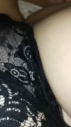 cellulitgirl